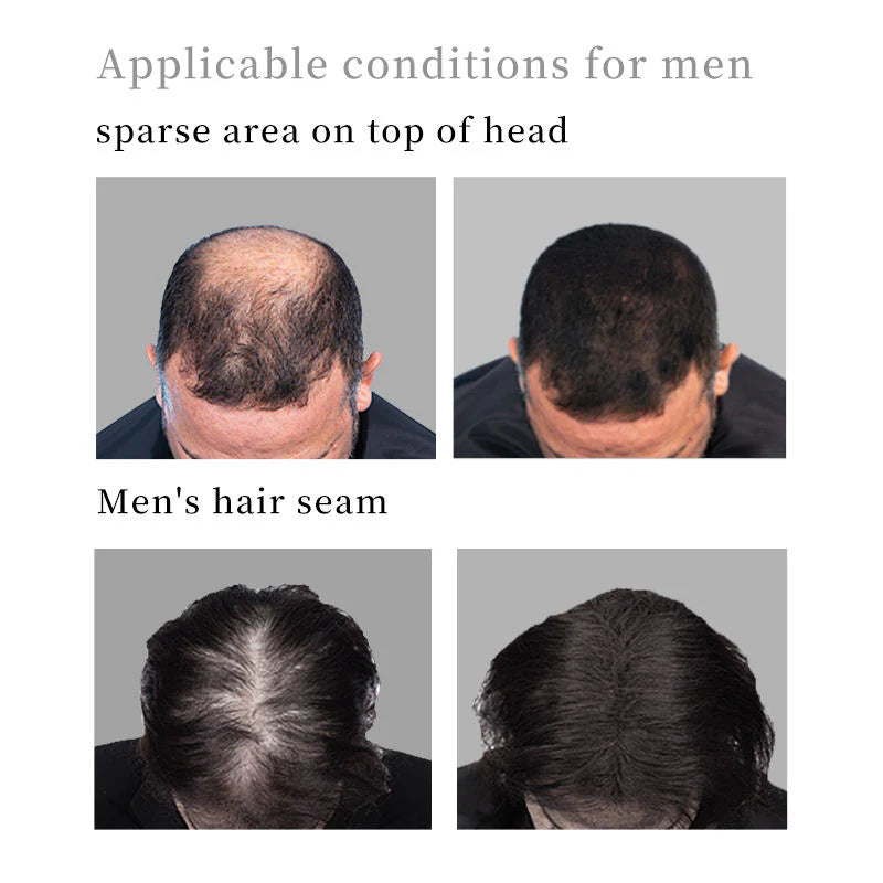 5 Second Hair Building Fibers For Men And Women