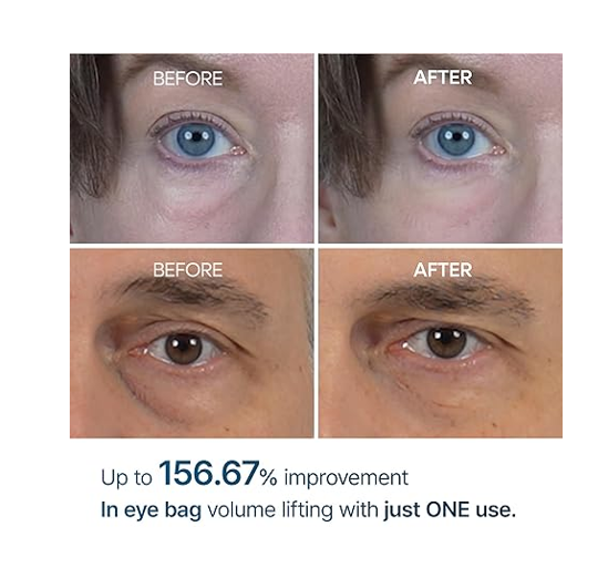 Dr.Melaxin Eyephalt Eyecream for Eyebags 0.33 fl oz (10 ml).