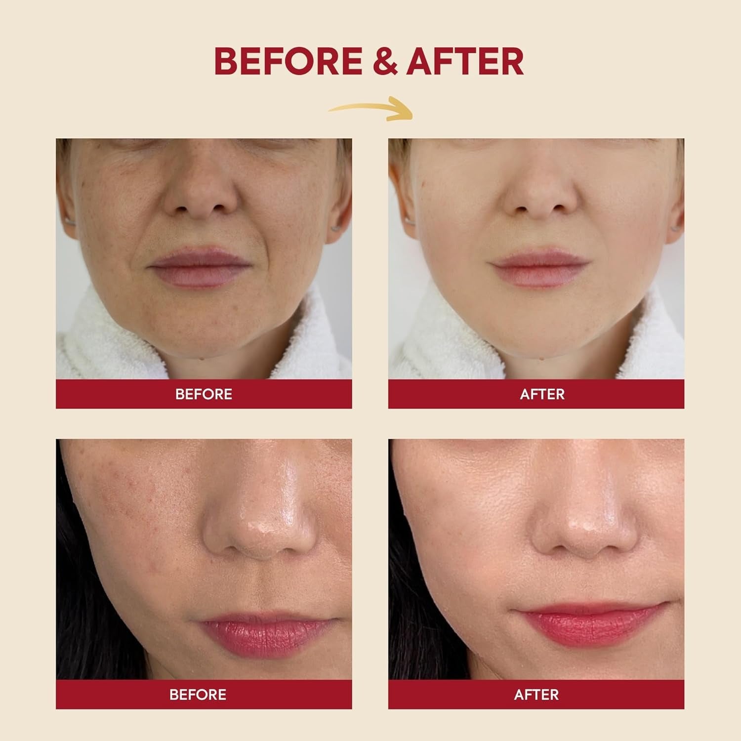 K-SECRET SEOUL 1988 Essence Snail Mucin 97% + Rice, 100ml