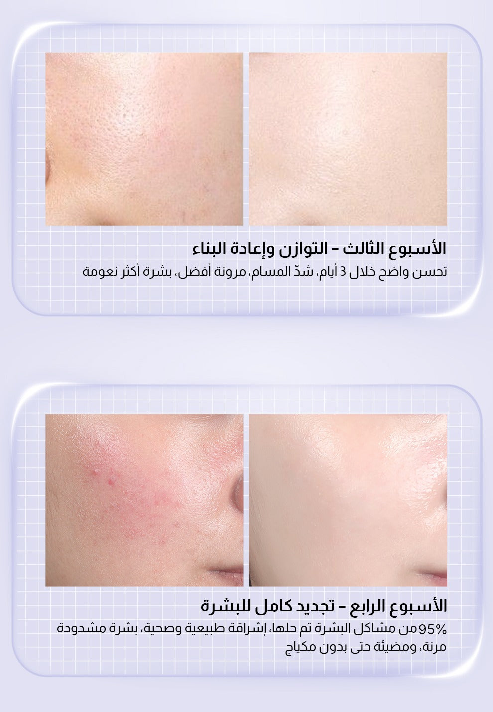 STUNYOU Moisturizing and Brightening Repair Ampoule Serum 1.5ml x 28 pieces